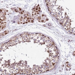 HECTD4 Antibody, Novus Biologicals:Antibodies:Primary Antibodies